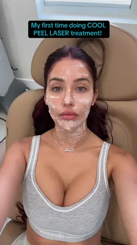 This treatment is good for wrinkles, scars, pigment & pores! An advanced laser skin treatment that utilizes a CO2 laser to remove the superficial layer of the skin with precision, promoting the growth of new, healthy skin! Also stimulates collagen production, rids skin of damaged cells, and improves overall texture, with minimal downtime!  Thank you so much @AZALA SKIN CLINIC for always getting me right! 