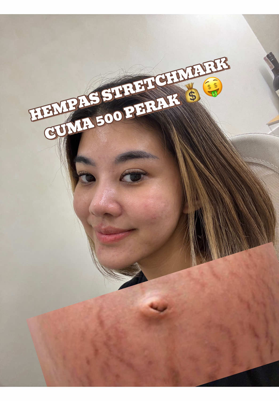 Tapi pake jangan bolong” sesuai mood ya. Sulit kalo itu 😡 wajib rutin kalo hasil mau bagus #stretchmarks #stretchmark #stretchmarkserum #stretchmarkoil #ciaraindonesia