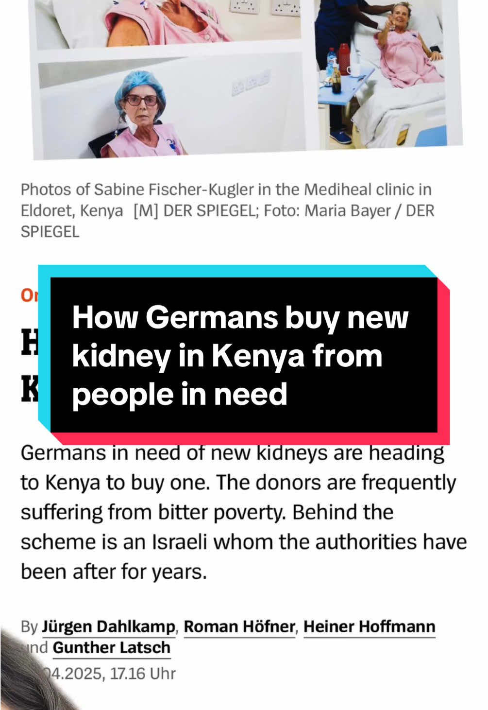 A new shocking article reveals how Germans in need of new kidney go to Kenya to exploit and target poor people in marginalized groups to then buy their kidneys. Most of the donors only get a few thousand euro for their organs #fy #foryou #fyp 