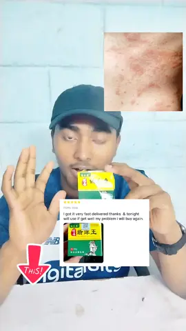 চুলকানির মলম allergy cream #মালয়েশিয়া_প্রবাসী_বাংলাদেশী🇧🇩🇲🇾 #malaysiatiktok #malaysiatiktok #TikTokShop #tiktokshopmalaysia #মালেশিয়া_প্রবাসী #মালেয়শিয়া_প্রবাসী_বাংলাদেশি🇧🇩🇱🇷 #allergyproblems @TikTok Malaysia @tiktokshop_my 🇲🇾 