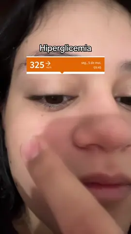 Você também incha durante uma hiperglicemia?  Quando a glicose fica muito alta, o corpo retém mais líquidos e a circulação piora, o que pode causar inchaço, especialmente no rosto. Isso acontece porque o sangue fica mais denso e os vasos têm dificuldade em funcionar bem.  #diabetestipo1 #vidacomdiabetes #diabetestype1 #foryoupage #hiperglicemia #diabetica 