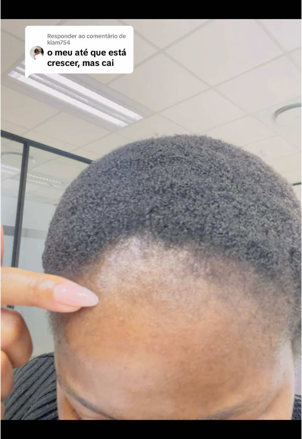 A responder a @kiam754  Queda de Cabelo pode ser falta de um Detox.  #blazukito #quedadecabelo #alopecia #cabelo 