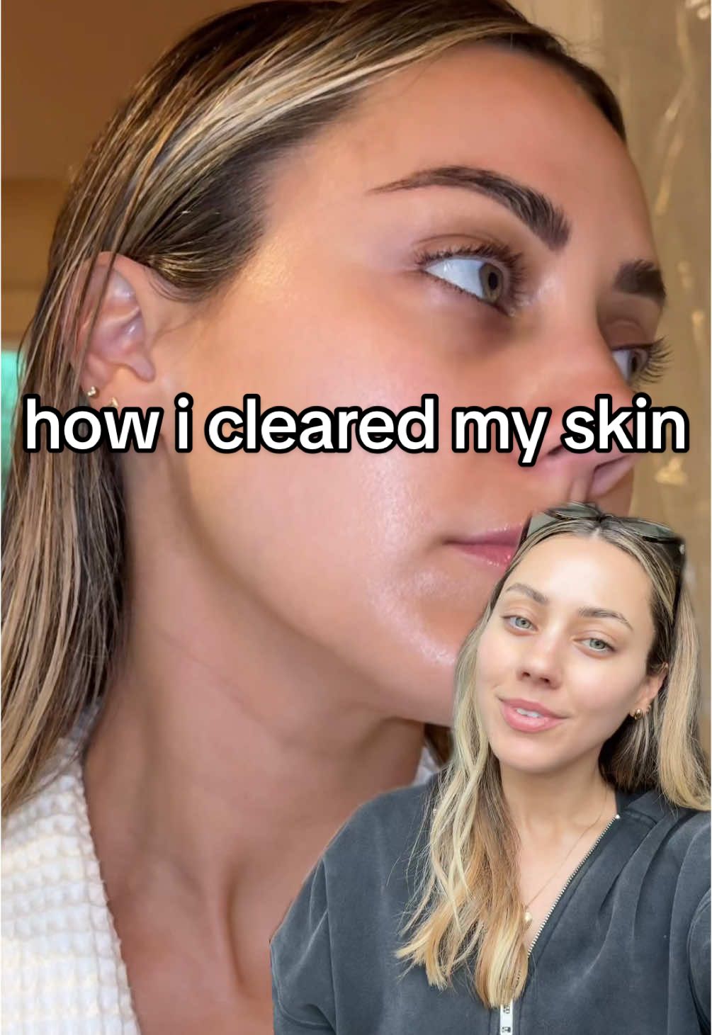 i feel like i need 20 parts to this but tried to keep it short and sweet! please let me know if you have q’s!!!  #skincare #skincareroutine #rosacea #sensitiveskin #clearskin #simpleskincare #skintransformation @rhode skin @First Aid Beauty @Clarins USA @Alpyn Beauty #greenscreen 