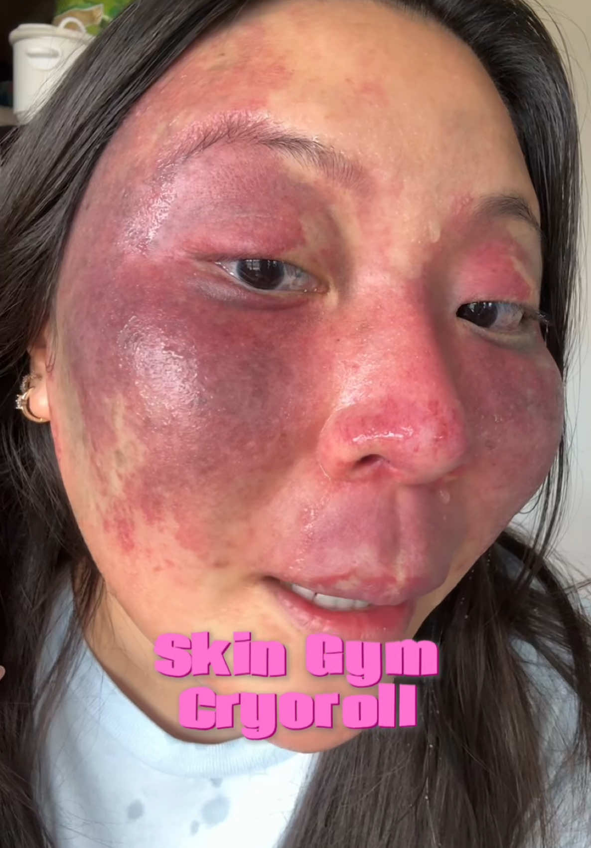 Had fun trying out the @skingym Cryoroller!!🧊🥶 #skincare #skinroutine #depuff #glassskin #beautytools #skincaretools 