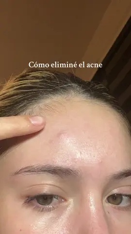 Encontré el retinal y no lo solté más🥰  #skincare #skintok #kbeauty #koreanskincare #skincareroutine #7days #retinalserum #acneserum #poreserum #rednessserum #skincare #skincareroutine@KSECRET GLOBAL #skincarecoreano #coreanos #retinol #retinolskincare #retinal #acne #acneskin #comosacargranos 