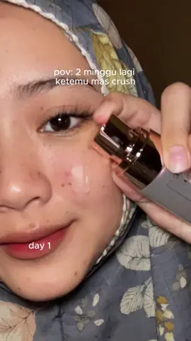 bye bye flek hitam & bekas jerawat 👋🏻  #skintific #377darkspotserum 
