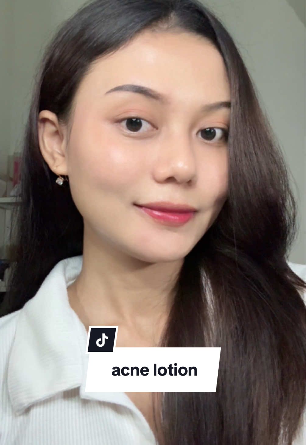 kata siapa jer*wat cuma muncul dimuka?🤔 nah kl kalian punya permasalahn jrwt di badan coba deh pake acne body lotion ini👌🏻 #Backane #AcneBodyLotion #Jevarine @By Jevarine Official 