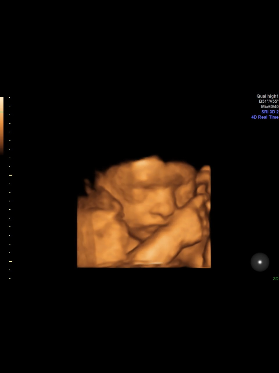 So, this is actually happening??...🥹  He was constantly wriggling around throughout the whole scan 😅  #4dscan #firstpregnancy #fetalmovement #pregnant🤰 #pregnancytiktok  #secondtrimester #pregnancytok  #26weeks #babymovements #4d #babyscan #ultrasoundscan  #babyultrasound 