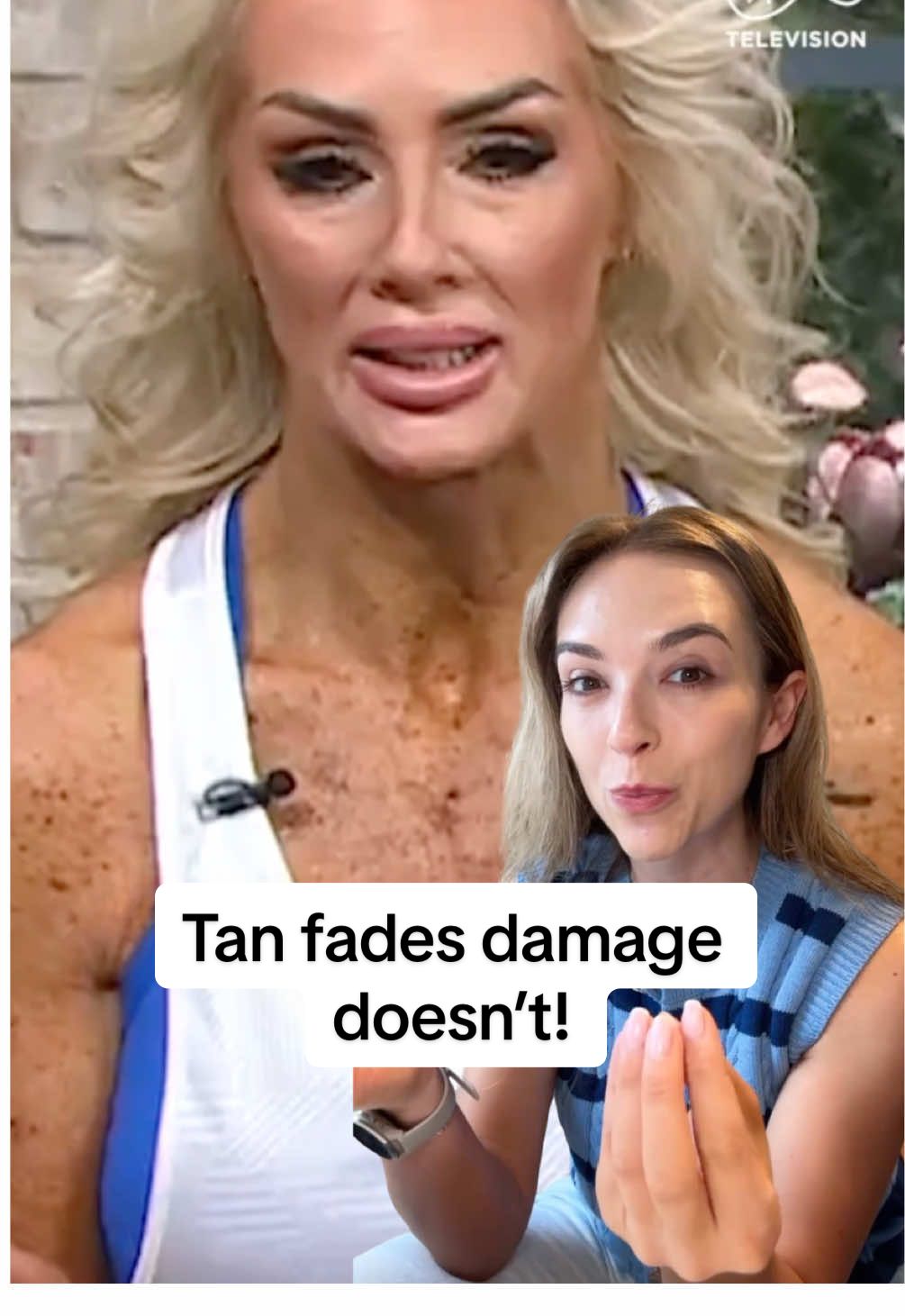 Public service announcement: there is NO such thing as a healthy tan 📣 Tanned skin is damaged skin. And while your tan will fade, the damage left behind doesn’t. Sunbeds and excess sun exposure accelerate the ageing and damaging process to the skin. While you may love the feeling and confidence it gives you right now, you won’t be happy with how your skin will be when you’re older.  Your future self will thank you 🙏🏼 Follow for more videos 💜 #skin #sunbeds #tanning #tan #tanned #sunbed 
