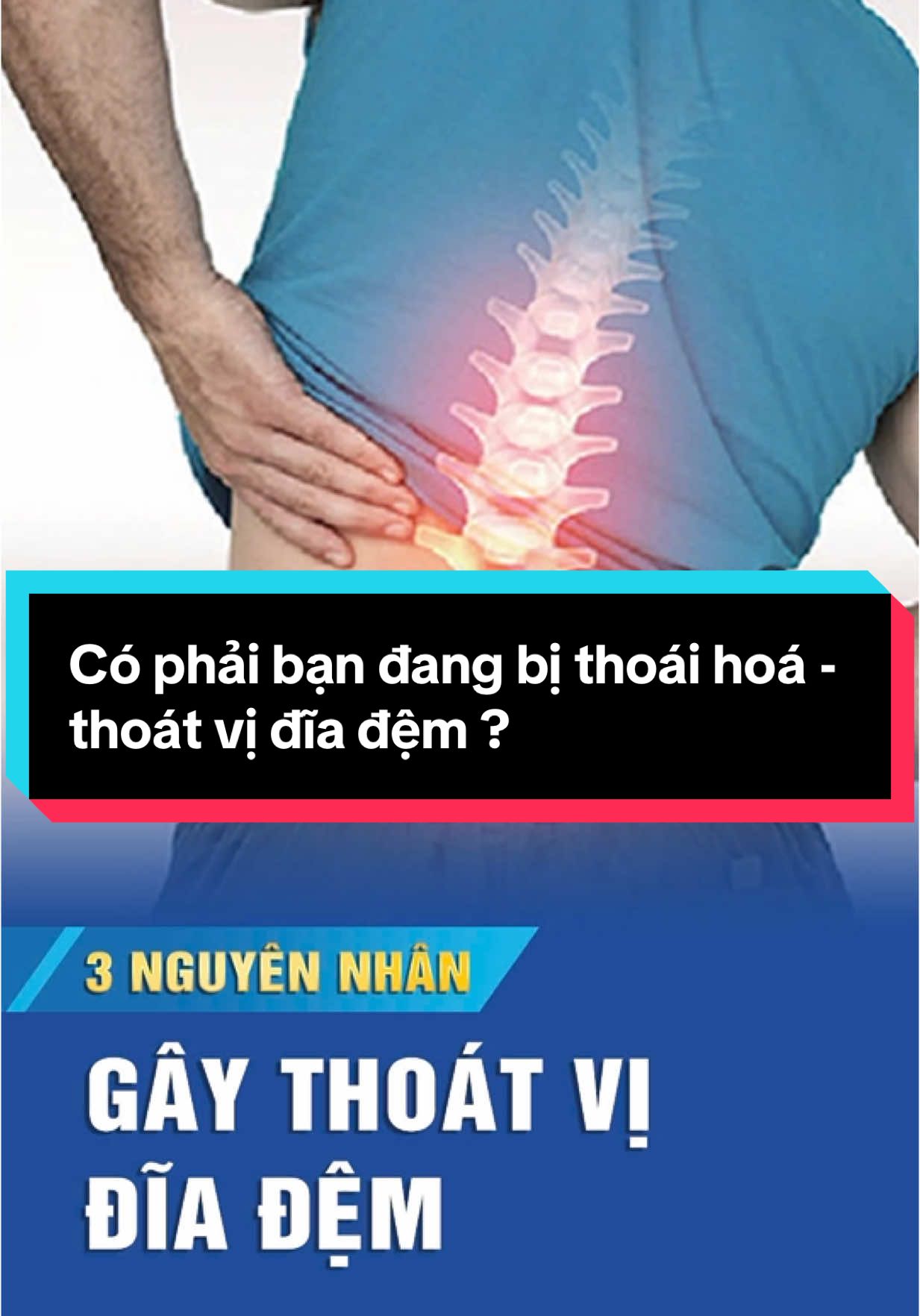 Có phải bạn đang bị thoái hoá - thoát vị đĩa đệm ?  #trending  #xươngkhớp #leva  #levaflex #mỹtơ  #đauxươngkhớp #thoátvịđĩađệm  #têbìchântay  #tràndịchkhớp #thoáihoácộtsống  #levaflexchínhhãng #levaflexchínhhãnggiábaonhiêu #đàiloan #nhậtbản #hànquốc #mỹ 