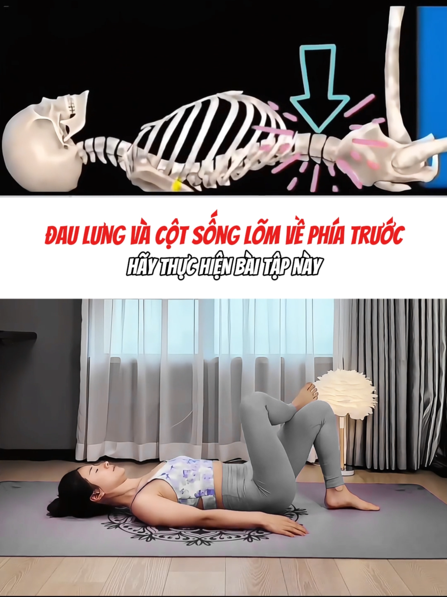 Đau lưng và cột sống lõm về phía trước hãy thực hiện bài tập này #đaulung #xhuongtiktok #coxuongkhop #baitaptainha #trilieuvientam #hoangdieptrilieu