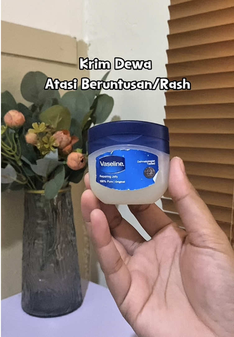 Andalan kalo eczema lagi flare up 🥹  #eczema #eczemafighter #pejuangeksim #dermatitisseborreica #dermatitis #dermatitisatopik #vaselinerepairingjelly 