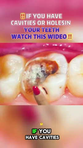 First time trying chewable toothpaste tablets 🦷 prioritize your dental health with (NOBS) #nobstoothpaste #nobs #chewabletooth #refesy