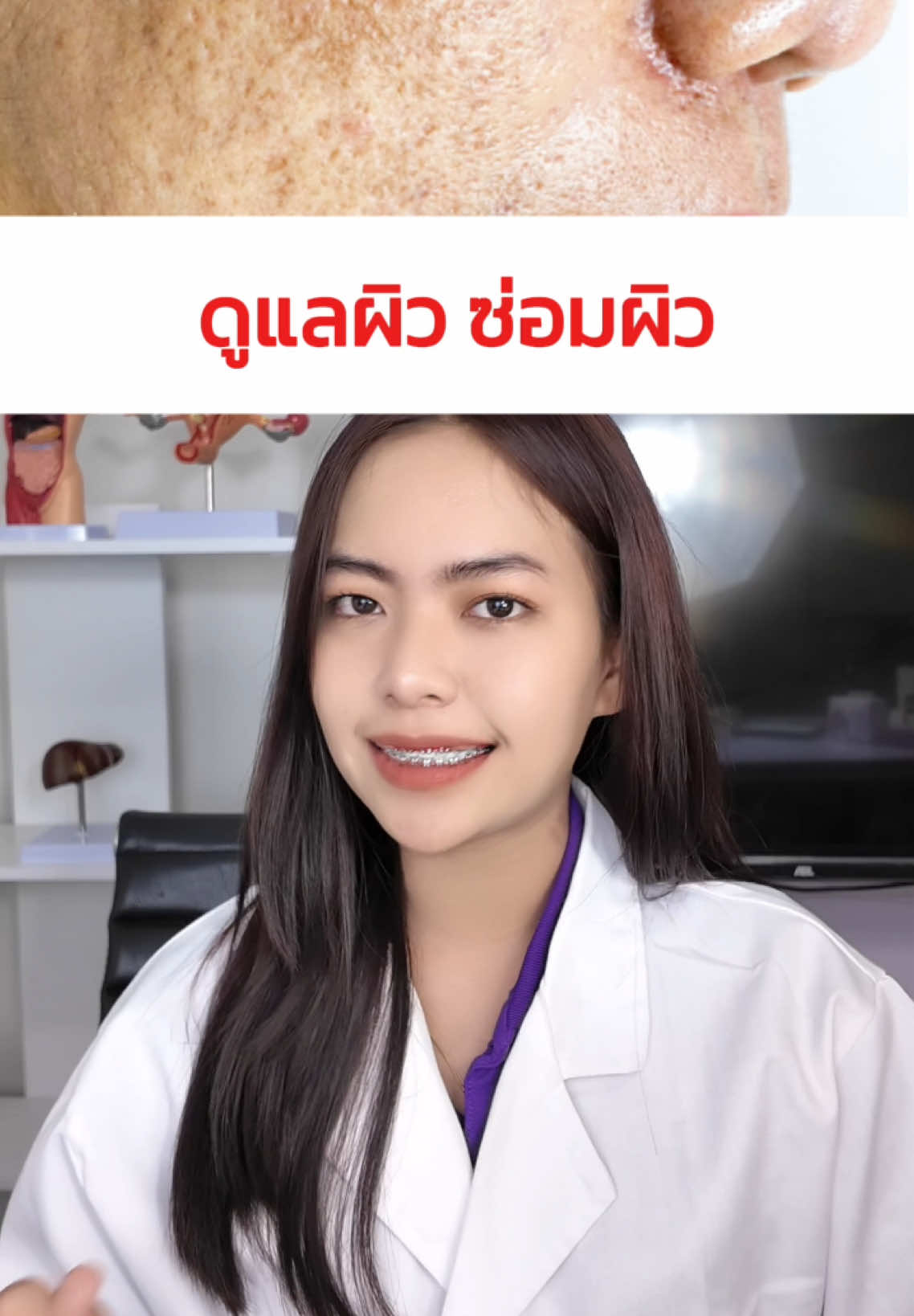 ดูแลผิว ตัวไหนดีที่สุด #อามิกลูต้า #ฝ้า #ฝ้าแดด #จุดด่างดําจางลง #กระ #ผิวหมองคล้ํา #ขาวจริง #ปัญหาฝ้า #หน้าแก่ #ผิวดีชีวิตดี 