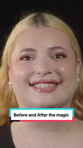 Before and After the magic. 🪄 #beforeandafter #veneers #dentistry #cosmeticdentistry #dentist #newsmile #austintx 