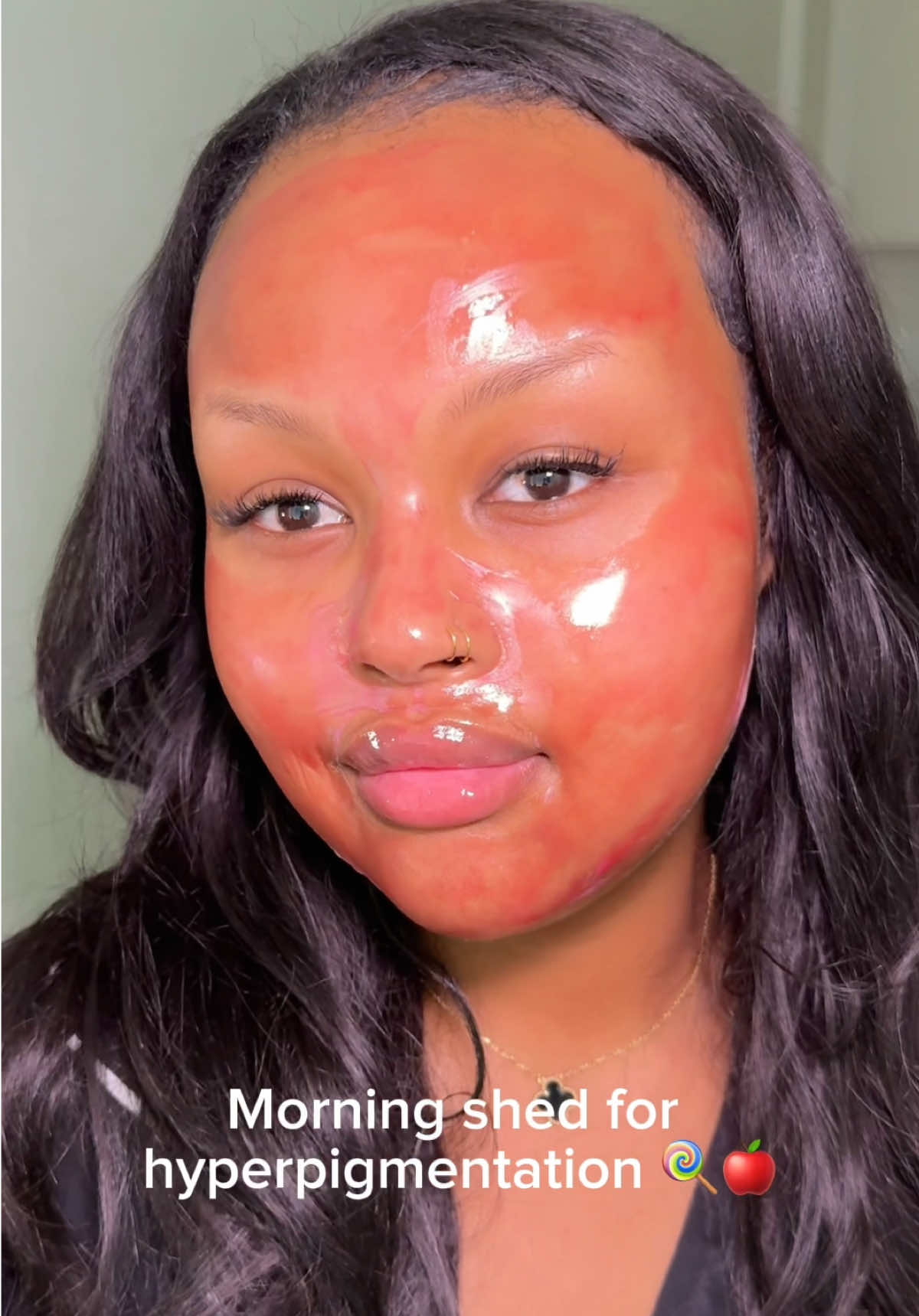 Morning shed 🍭🍎 @APRILSKIN USA ad #APRILSKIN #APRILSKINskincare #darkspotwrappingmask #candyglowmask #morningshed #darkspots #hyperpigmentation #sephora #ulta #koreanskincare #mothersday #mothersdaygift