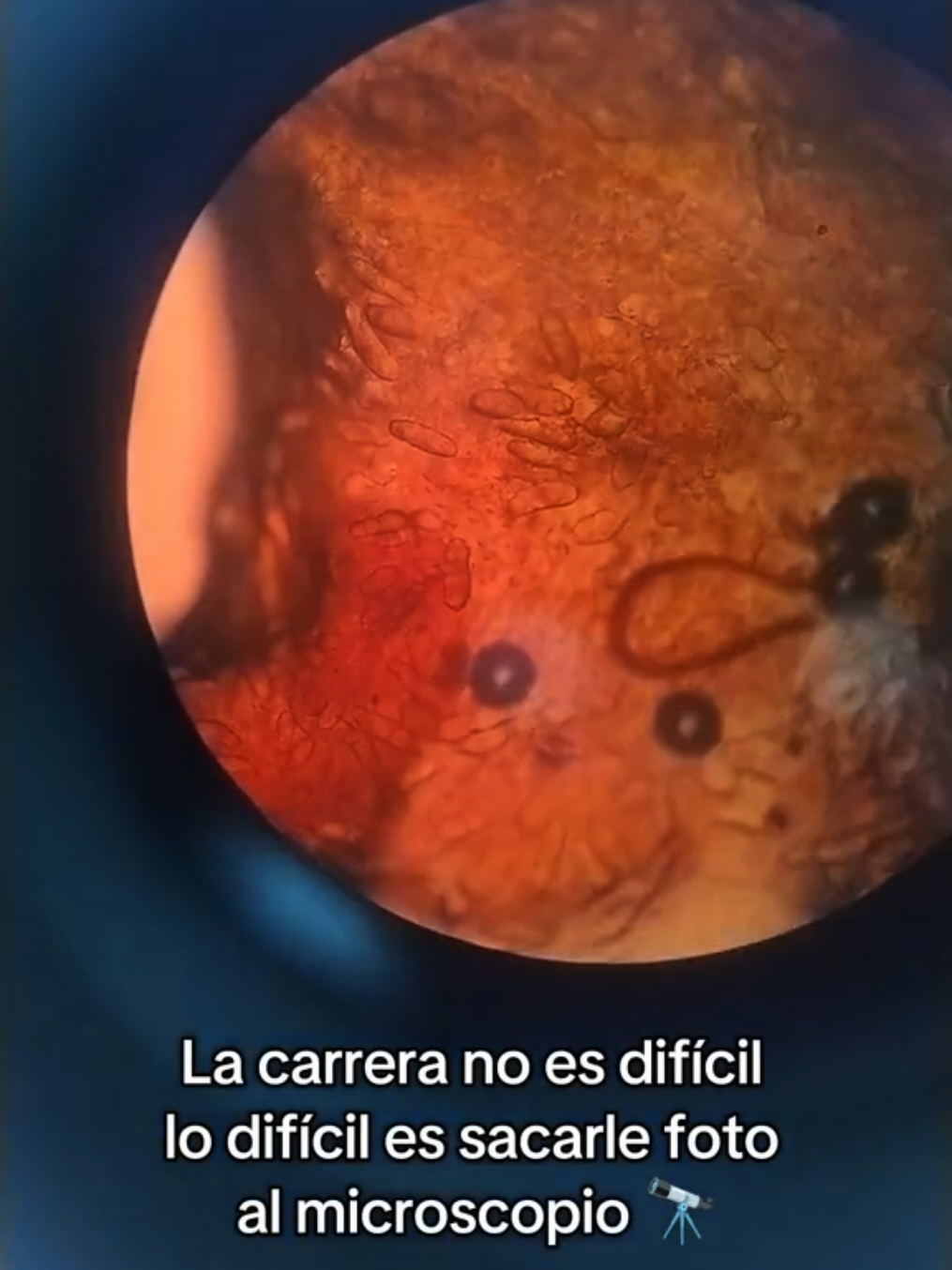 Lo difícil es sacar foto 🔭 #laboratory #microscopy  #pfy #veterinary #humor#zcbxya#funnytiktok