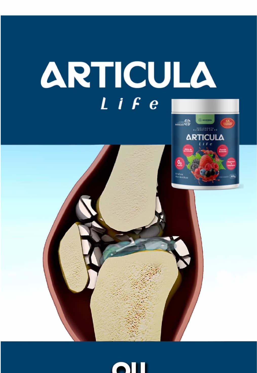 Esse suplemento transforma vidas 😍 #suplementosdeportivos #articulalife #doresnocorpo #dornasarticulacoes 