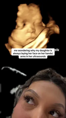 like mother like daughter I guess 🤭🤭👯‍♀️ #greenscreen #foryou #fyp #foryoupage #pregnant  #firsttimemom #2025baby #thirdtrimester #babyultrasound 