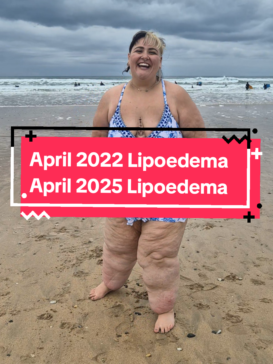 our bodies hold trauma, and stress. one of the main factors with lipoedema is stress levels. My lipoedema used to be so solid, it was so heavy, and even before using a GPL1 medication, once I was in a safe space, a continuous calm environment, my lipoedema became more soft. Obviously the GPL1 medication has added to that, and the difference in the texture of my legs in these two clips is insane. My life has totally changed for the better, as so has my body, my mind and my soul 💫  #lipoedema #lipedema #lymphedema #cortisol #cortisollevels #traumahealing #healing #therapy #dvawareness #abuse #fyp #mounjaro #mounjaroupdate #nervoussystemregulation #peaceful #safe #plussizeblogger #plussizetiktok 