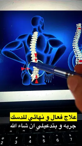 #الم_الظهر #خشونة_الركبة #احتكاك_الركب #الدسك #السعودية