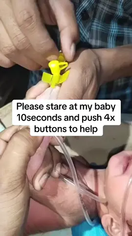 #foryoupage #sickbaby#babytiktok #humanity #sickbaby #support #canada #america#please🙏 