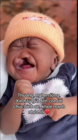 #treem #khuyettat #nghilucsong #khoemanh #baby #fyp #xh #nguoivietnam 