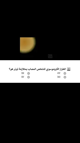 متلازمة تيرنر تجي للبنات فقط يعني xoxo gossip GIRL #ربط_تحصيلي #تحصيلي #قياس #fyp 