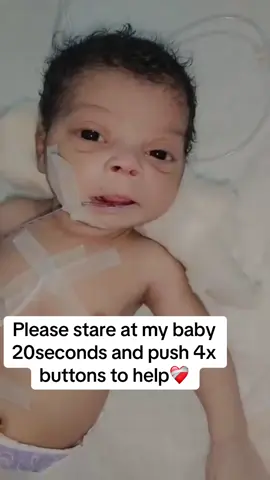 #foryoupegy #babytok #sickbaby #humanity #sickbaby #support #canada #america #sickbaby #please🙏 #