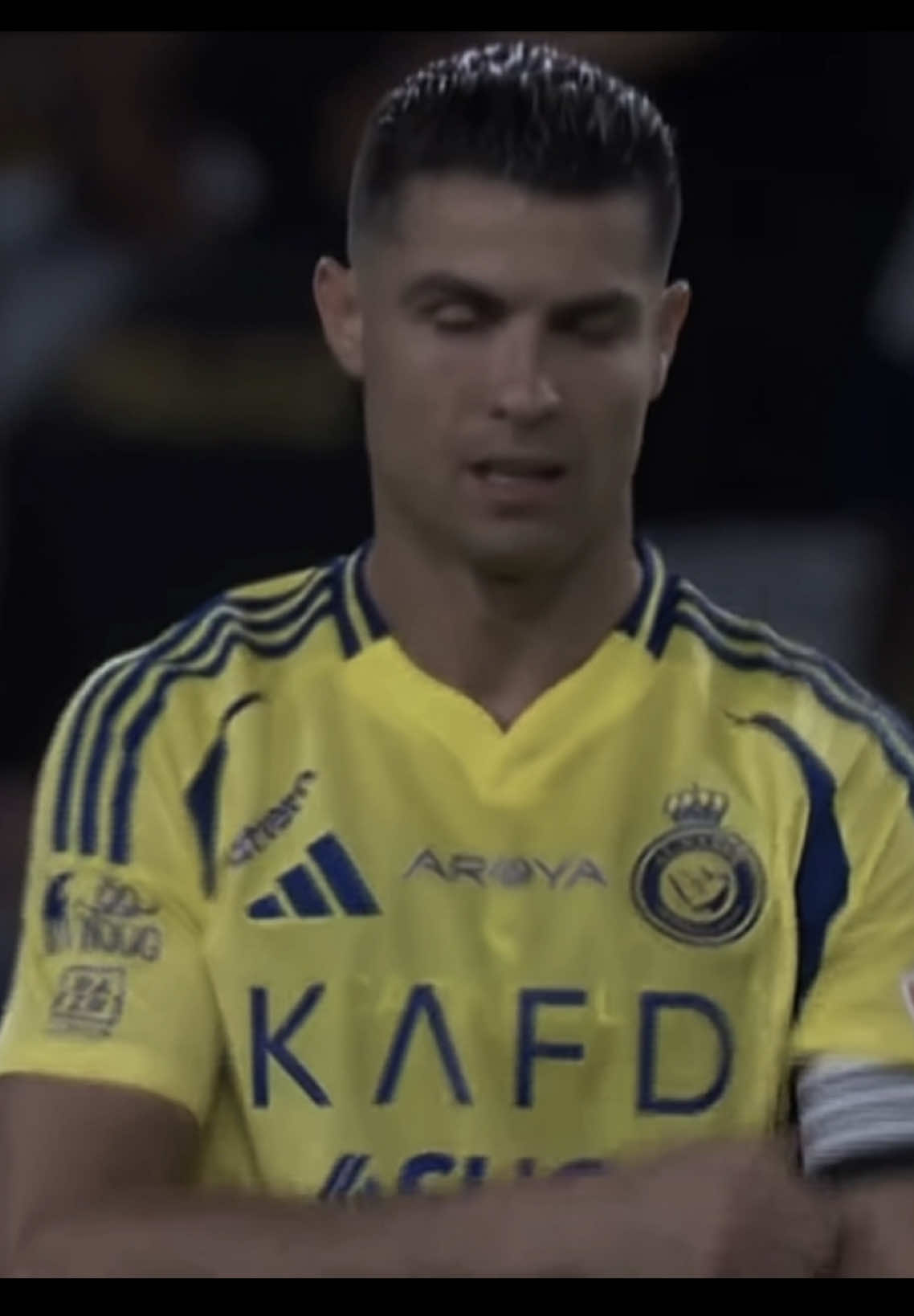 Al-Nassr is bleeding again!😞 #alnassr #ittihad #Classico #النصر #fyp #nfc 