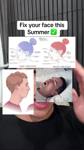 Fix your face this summer ✅ #looksmax #looksmaxing #jawline #looksmaxx 