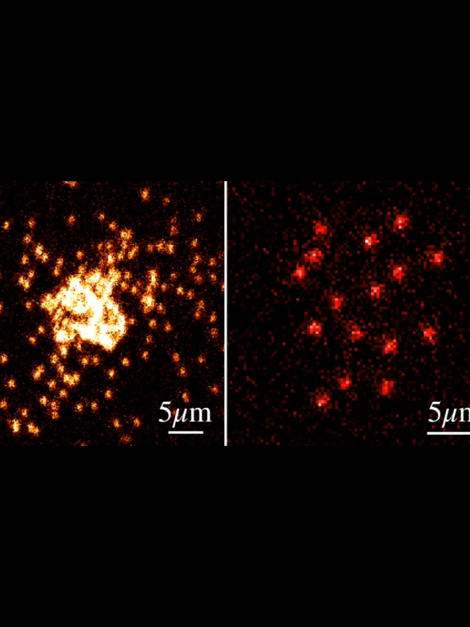 FÍSICOS CAPTURAM AS PRIMEIRAS IMAGENS REAIS DE ÁTOMOS EM MOVIMENTO #QuantumPhysics #ScientificBreakthroug #MITResear #ScienceNews  Physicists snap the first images of 'free-range' atoms Pela primeira vez na história, cientistas capturaram imagens reais de átomos individuais interagindo livremente no espaço.  Um feito que transforma teoria em realidade visível  e que promete revolucionar nossa compreensão da matéria. Essa conquista extraordinária veio do MIT, o Instituto de Tecnologia de Massachusetts. Usando uma técnica inovadora, os físicos conseguiram observar, com clareza inédita, a dança invisível das partículas que constituem tudo o que vemos.  As imagens foram publicadas na revista Physical Review Letters, e mostram correlações entre partículas que, até então, só existiam nos cálculos da mecânica quântica. Mas como se fotografa o invisível?  Um único átomo tem cerca de um décimo de nanômetro de diâmetro.  É um milionésimo da espessura de um fio de cabelo humano.  E como se não bastasse esse tamanho minúsculo,  os átomos obedecem às leis estranhas do mundo quântico — o que significa que não podemos saber exatamente onde eles estão e ao mesmo tempo qual a velocidade com que se movem.  É o famoso princípio da incerteza. Até agora, cientistas usavam métodos como a imagem por absorção, em que a luz de um laser projeta a sombra de uma nuvem de átomos numa tela.  Mas isso só mostra a forma geral da nuvem — não os átomos em si.  É como observar uma nuvem no céu e tentar adivinhar onde estão as moléculas de água que a compõem. Foi aí que o grupo liderado por Martin Zwierlein entrou em cena com uma abordagem radicalmente diferente.  Eles desenvolveram uma técnica chamada microscopia de resolução atômica.  Primeiro, eles aprisionam uma nuvem de átomos numa armadilha de luz fraca — como se fosse um berço feito de laser.  Dentro dessa armadilha, os átomos podem se mover e interagir livremente. No momento certo, os cientistas ativam uma espécie de rede óptica, que congela os átomos no espaço — como uma fotografia de uma cena em movimento.  Em seguida, outro laser, ajustado com precisão extrema, ilumina esses átomos suspensos. O que a câmera captura é pura física quântica, em alta resolução. Zwierlein descreveu o desafio: u  era preciso captar a luz dos átomos sem “cozinhá-los” — sem aquecê-los até que escapassem da rede.  Um equilíbrio delicado. Mas eles conseguiram. E pela primeira vez, os cientistas puderam ver, um por um, os átomos interagindo de verdade. A equipe aplicou essa técnica para estudar dois tipos fundamentais de partículas:  bósons e férmions. A diferença entre eles está no spin, um número quântico ligado à rotação das partículas.  Quando o spin total — que depende da soma de prótons, nêutrons e elétrons — é um número inteiro, o átomo é um bóson.  Se for um número meio-inteiro, é um férmion. Em termos simples: bósons gostam de se juntar. Férmions se repelem. Usando átomos de sódio, que são bósons, os pesquisadores observaram o famoso condensado de Bose-Einstein — um estado exótico da matéria onde todos os átomos ocupam o mesmo estado quântico.  Imagine milhares de partículas se comportando como uma única onda. Isso já havia sido previsto no século passado, mas agora foi observado em tempo real, com resolução atômica. Louis de Broglie, em 1924, foi o primeiro a sugerir que partículas de matéria também podiam se comportar como ondas.  A ideia parecia absurda à época. Hoje, essas ondas de matéria são uma realidade visível em laboratório.  Os bósons de sódio mostraram exatamente isso: uma única onda quântica formada por muitos átomos individuais, cada um visível em sua posição — e todos, incrivelmente, interligados. Mas a equipe foi além.  #FísicaQuântica #DescobertaCientífica #MITBrasil #CiênciaNews #QuantumPhysics #ScientificBreakthroug #MITResear #ScienceNews