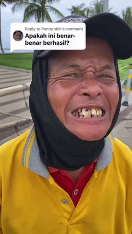 Apakah Anda memiliki bau mulut selama 10 tahun, atau gigi kuning selama 5 tahun, pasta gigi niacinamide FSMILE ini dapat memberikan efek pemutihan maksimal tanpa merusak email gigi, membuat senyum Anda lebih putih!#gigi #Fsmile #pastagigi Niacinamide#pastagigi #pemutihgigi#tiktok #teethwhitening #pastagigi