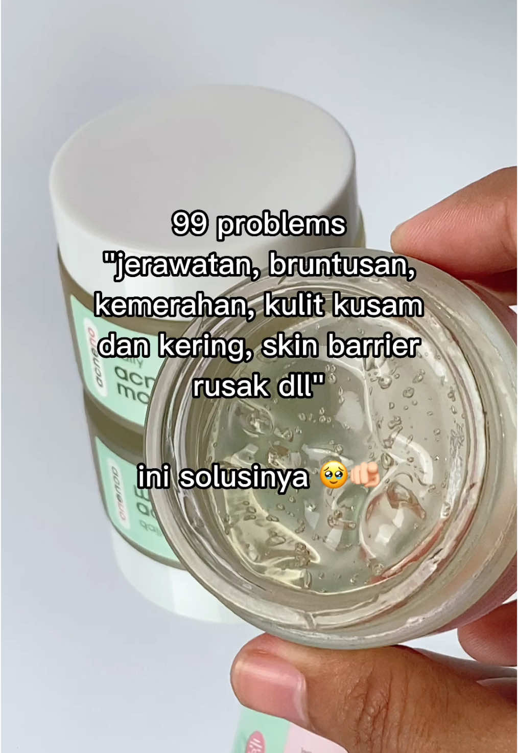 Skin barrier rusak? Ini solusinya 🫵🏻✨ #moisturizeracneno #skinbarrier #jerawat #acnefighter 