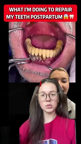 Check out this video. You know how you've been brushing your teeth for years and they're still yellow? It's because you didn't choose the right toothpaste! #Bodyaccle #toothpaste #yellowteeth #badbreath #teethwhitening #oralhealth #teethcleaning #tiktokmademebuyit #toothpaste #toothpaste #toothwhitening #gingivitis #badbreath #yellowteeth #teeth #tooth #teethwhitening #badbreath #toothdecay #foryou #TikTokShop #TikTokMadeMeBuyltl#teethcare #dealsforyoudays #teethwhitening #oralhealth #whiteningteeth#tiktokshopholidayhaul #FallDealsForYou #glamvorateethwhitening 