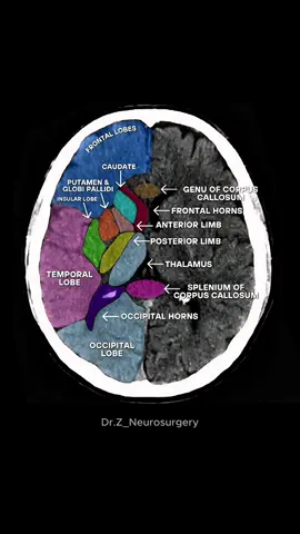 Inside this maze of matter lies every memory, every move, every mistake. The architecture of your entire existence. #Neuroscience #BrainScan #CTScan #Medicine #Neuroanatomy #Science #MedicalStudent 
