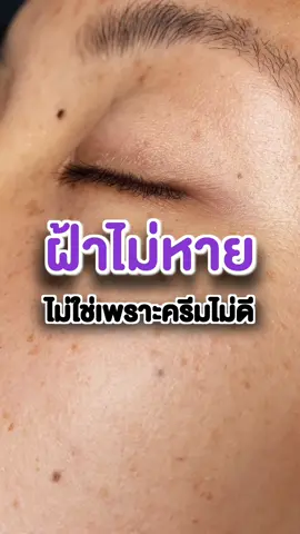 ฝ้าไม่หายไม่ใช่เพราะครีมไม่ดีแต่เพราะคุณลืมดูแลตรงนี้ #ฝ้า #ดูแลผิว #เคล็ดลับหน้าเด็ก 