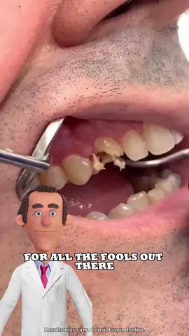 FOR ALL THE FOOLS OUT THERE#toothpaste #whiteningteeth #dentist#springtok