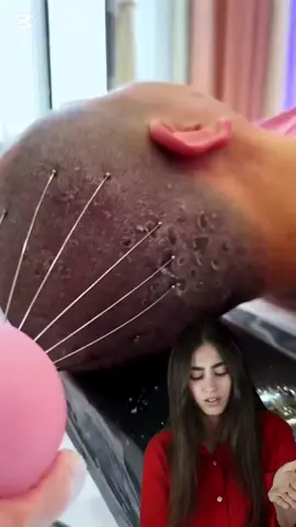 #asmr #راحة_نفسية ازالة قشر الشعر مررة مريح