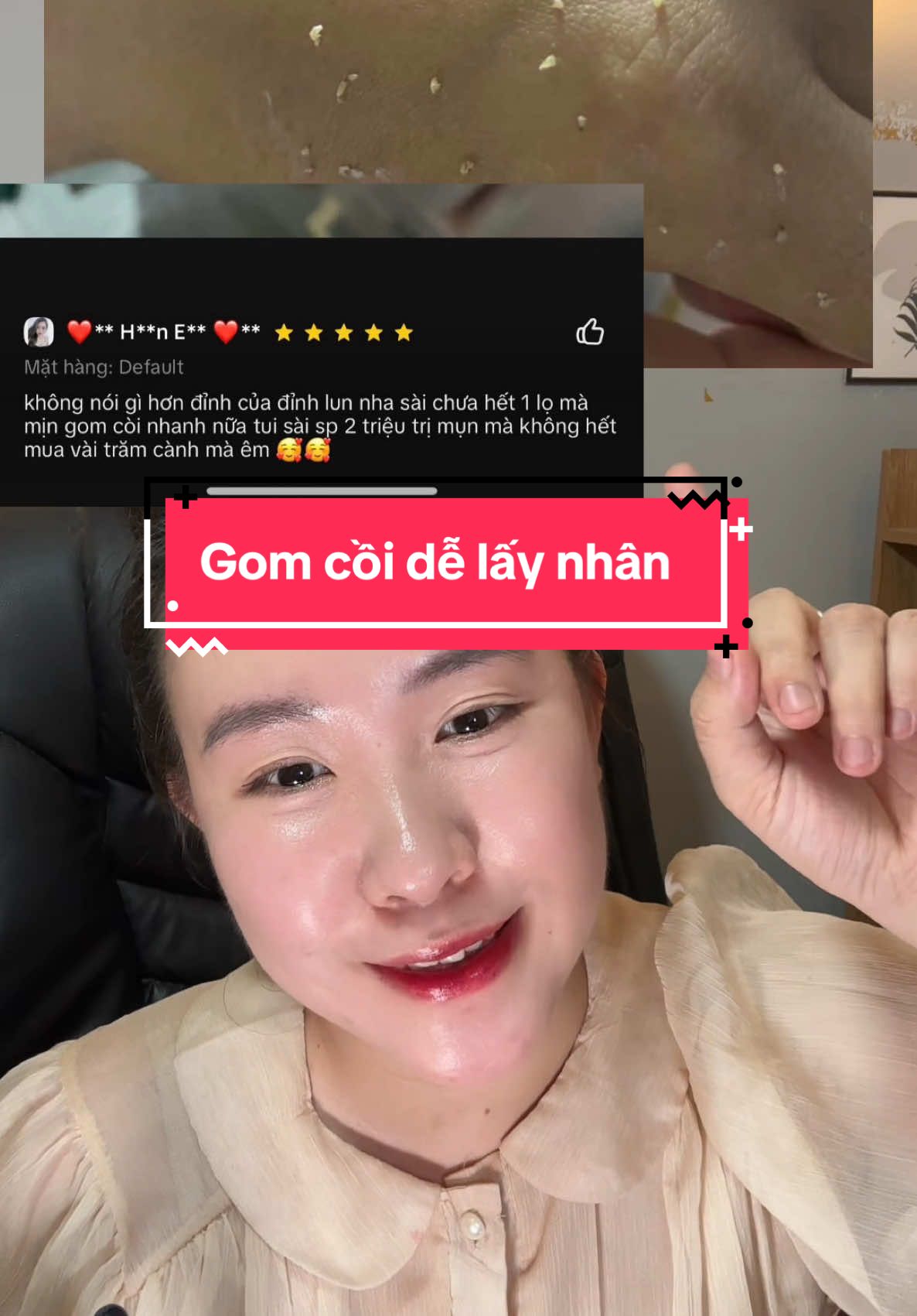 #gomcoimunsau3den10ngay #gomcoimunbenus #kieuthuygomcoimun #chammunbenus #trimunbenus #tinhchatgomcoimunbenus 