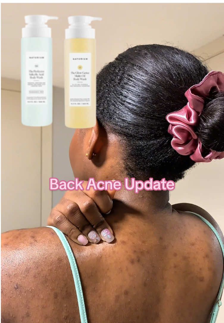 Results Using @Naturium perfector salicylic acid wash and multi oil glow getter for almost 2 months.  I have now up graded to add the Smoother glycolic acid body wash to my routine along with their Kp Body Scrub and Mask #naturium #naturiumskincare #bodyacne #skincareproduct #hyperpigmentation #girlproblems #sensitiveskin #torontocreator #bacne #bodycareproducts #productreview  