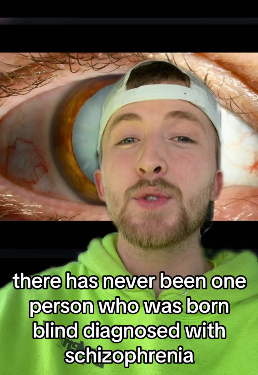 The interesting world of schizophrenia 😳😳       #greenscreen #schizophrenic #MentalHealth #awareness #interesting #medicine #doctor #facts #themoreyouknow 