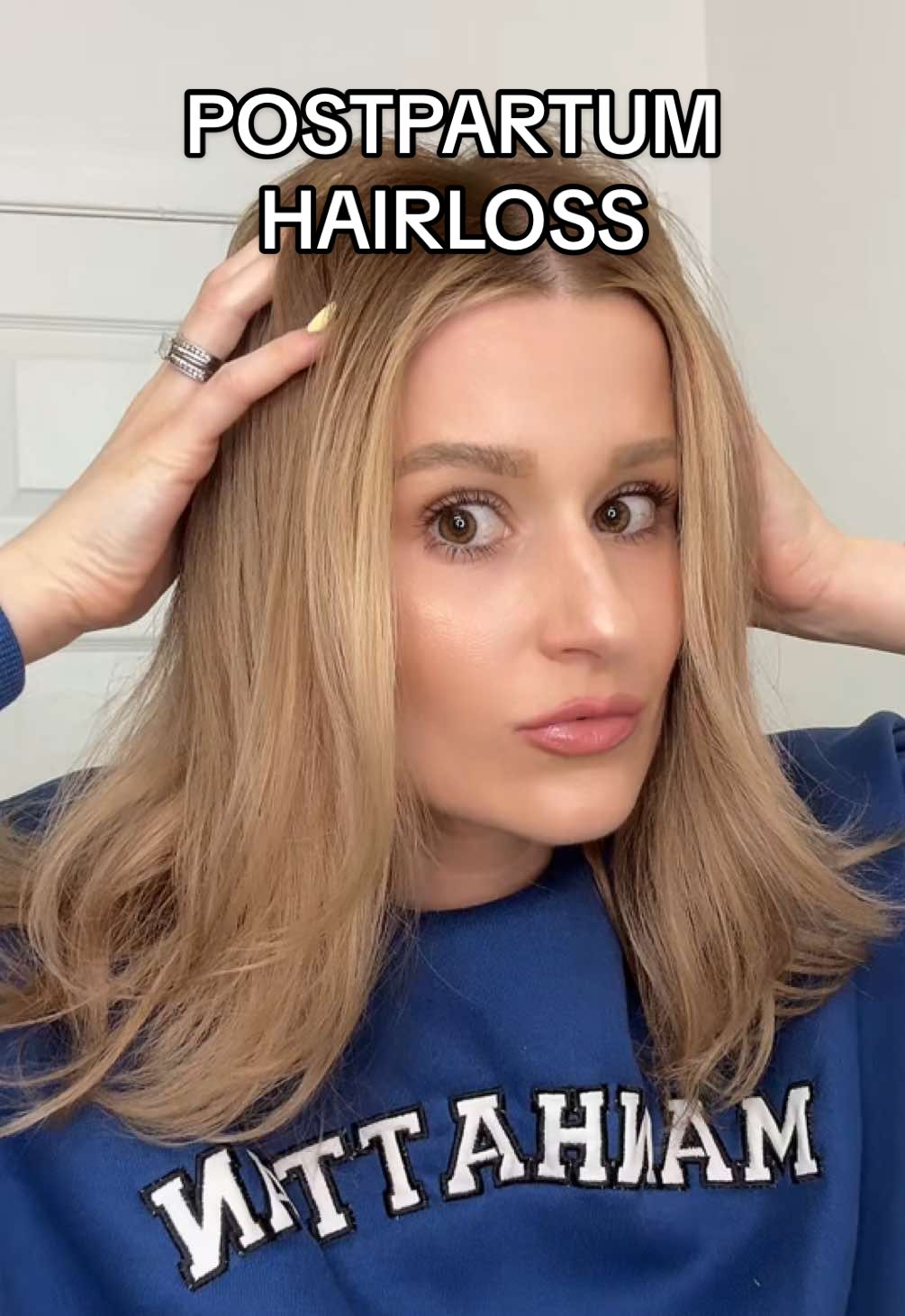 GIRLIES: PRODUCT RECOMMENDATIONS PAAHHPLEAAASEEEEEE 😆🙏🏼💕🥴😩 #postpartumrecovery #postpartumhairloss #hairloss #hairproducts #thinhair #thinninghair #newmomtips #thinninghairsolution 