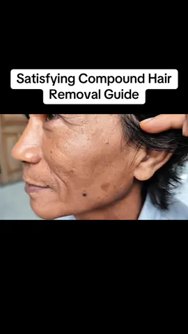 Satisfying Compound Hair Removal Guide #hairremoval, #skincare, #satisfyingvideos, #beautytips, #SelfCare  