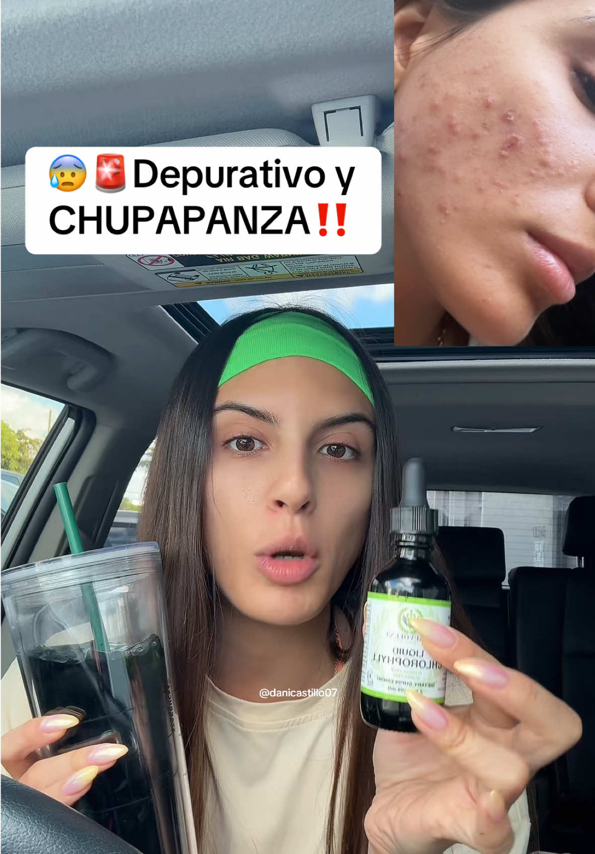 Dios 😰😰😰😰que resultados los de la clorofila 🥵🥵 #resultsmayvary #clorofila #clorofilaliquida #belleza #bienestar #mujer #mujeres #acne #cuerpo #cuidadodelapiel #cuidadopersonal #tiktokshop #tiktokshop #mothersday #tiktokshopmothersday #diadelasmadres #usa_tiktok #usatiktok #tiktokusa #tiktokviral  Disclaimer: Este producto no está diseñado para diagnosticar, tratar, curar o prevenir ninguna enfermedad. Los resultados pueden diferir entre individuos. Se recomienda consultar a un profesional de la salud antes de iniciar cualquier tratamiento o usar un nuevo producto relacionado con el bienestar.