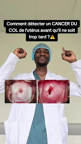 Comment détecter un cancer du col avant qu’il ne soit trop tard. #docteur #italy #usa_tiktok #tiktokfrance🇨🇵 #docteurnevylbakala #ConseilsSanté #cancer #col #uterus 