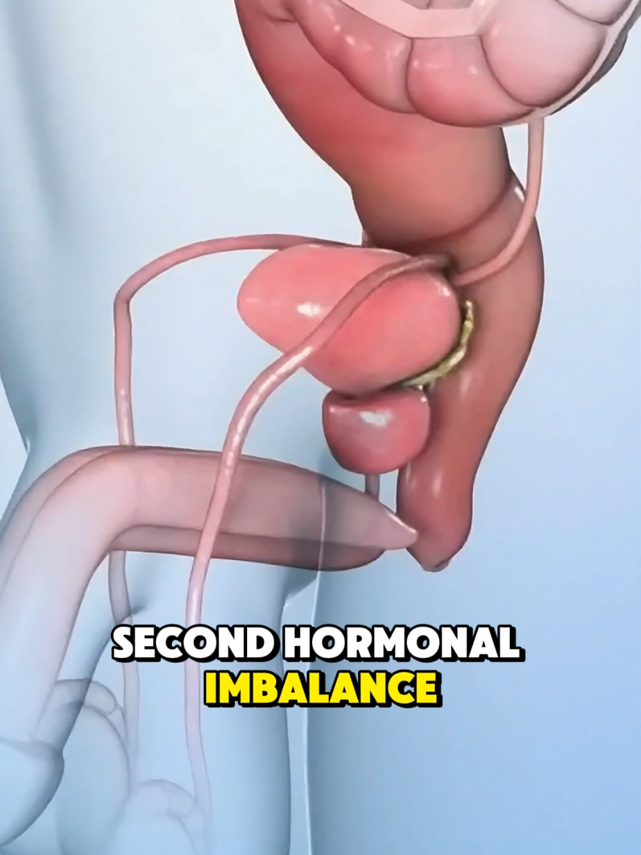 Most Common Causes Of Bening Prostatic Enlargement(3D Animation) #treatmentofprostateenlargement #bph #benignprostatichpyerplasia #Enagrdeenlarged #prostatecancer #medical3danimation #3Dmedicalanimation #health 