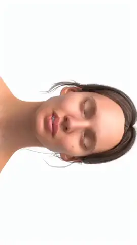 Restore function and beauty with Z-plasty & V-Y advancement! 💉 This complex surgical technique repairs lip trauma, tumor removal, and birth defects, minimizing scarring and distortion. Geometry meets precision medicine! 🔄 #TraumaRecovery #PlasticSurgery #ScarRevision #LipReconstruction #TraumaHealing #SurgicalExcellence  #TraumaRecovery #LipReconstruction #PlasticSurgery #SurgicalPrecision #TraumaHealing #ReconstructiveSurgery #curemedicalcomplex #cmc #curememedical #cureme 