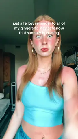 DO NOT go tan for tan with your friends WITHOUT sunscreen #sunburn #inpain #fyp #UGH #fml #ndsu #college 