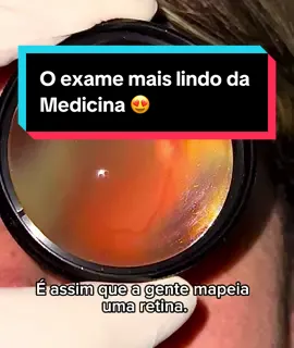 O exame mais lindo da Medicina 😍 Não invasivo e capaz de diagnosticar inúmeras doenças. Não deixe de consultar o seu oftalmologista regularmente! #fundodeolho #retinopatia #catarata #visao #oftalmologia #fy